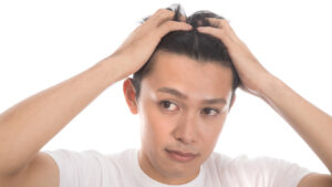 育毛剤は何歳から使うべき?ハゲていなくても必須?